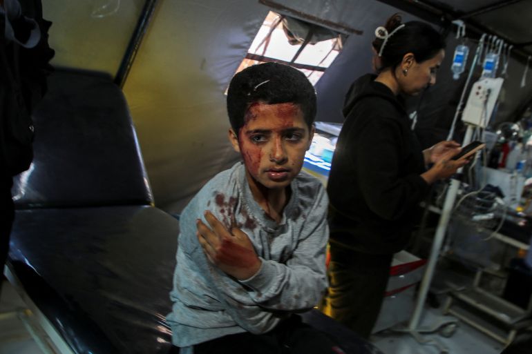 SENSITIVE MATERIAL. THIS IMAGE MAY OFFEND OR DISTURB A Palestinian boy wounded in an Israeli strike waits to receive treatment at a hospital as Israeli forces launch a ground and air operation in the eastern part of Rafah, amid the ongoing conflict between Israel and Hamas, in Rafah, in the southern Gaza Strip May 7, 2024. REUTERS/Hatem Khaled